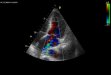 Echocardiographics, stress tests